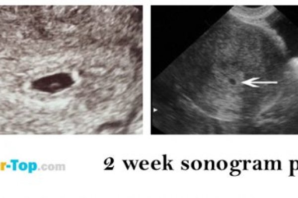 Кракен ссылка на сайт